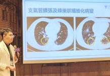 肺纖維化非絕症!奇美醫院多管齊下治療,讓硬化肺部「踩煞車」